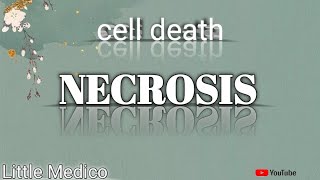 Necrosis and types of necrosis pathology robbins [upl. by Skye]