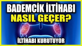 Bademcik Şişmesine Ne iyi Gelir Bademcik İltihabı Nasıl Geçer [upl. by Neret]