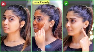 No Gelatin NEW PERMANENT FACIAL HAIR REMOVAL AT HOME  Rinkal Soni [upl. by Arjan347]