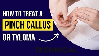 How to treat a pinch callus or Tyloma How to stop a pinch callus from reforming [upl. by Elyrpa]