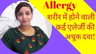 Allergy treatment  allergy homeopathic medicine  skin food dust allergy homeopathic treatment [upl. by Ayotl759]