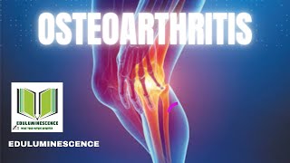 Osteoarthritis in hindi  Pathophysiology symptoms and management of Osteoarthritis Eduluminesce [upl. by Luby862]