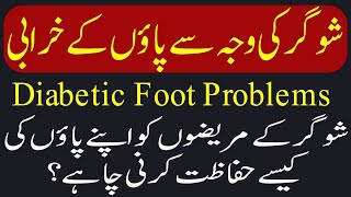 Diabetic Foot Problems in Urdu  Sugar Ki Bimari  Diabetes Complications  By Dr Saber Hussain [upl. by Isoj]