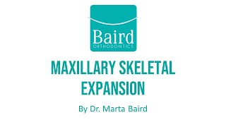 Orthodontic Maxillary Skeletal Expansion Traditional amp InvisalignR Palatal Expander [upl. by Shayn]