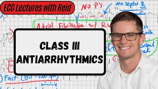 Class III Antiarrhythmic Agents  ECG Lecture [upl. by Gorden]