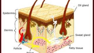 DermTV  Enlarged Oil Glands Sebaceous Hyperplasia DermTVcom Epi 287 [upl. by Ahsenaj]