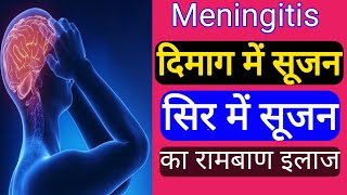 दिमाग की सूजन  सिर में सूजन  Meningitis best treatment  रामबाण इलाज [upl. by Radford715]