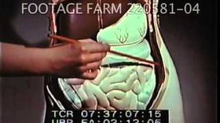 Penicillin in Medicine and Surgery 22058104mp4  Footage Farm [upl. by Enitnemelc373]