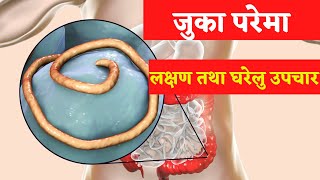 आन्द्राको कीराका सामान्य लक्षणहरू हुन्  Juka Jukako Ausadhi Jukako Symptoms  Upachar [upl. by Nomelihp674]