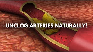 EAT These 10 HeartHealthy Foods For Your Clogged Arteries [upl. by Astrea348]