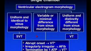 ICD Troubleshooting  Dr Friedman Mayo Clinic [upl. by Ngo703]