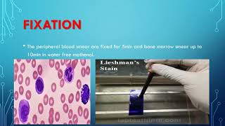 leishman stain procedure [upl. by Hcab703]