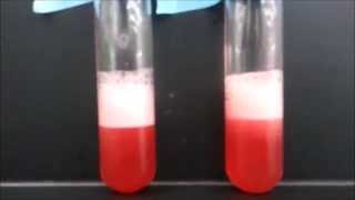 DNA Extraction Strawberry [upl. by Trebleda]