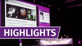 PCR London Valves 2017 relive the highlights of this years edition [upl. by Imoyn]