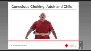 Conscious Choking  Adult and Child [upl. by Enialedam]