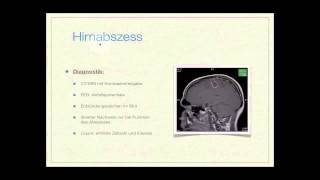 Basiskurs Neurologie Entzündliche Erkrankungen Teil 814 [upl. by Bogie]