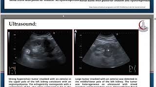 Clinical Genitourinary Module  Radiology amp Andrology [upl. by Hurlee]