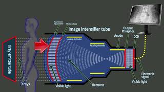 Fluoroscopy  Xray intensifier tube  Basic functions [upl. by Amias]