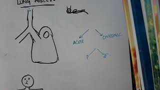 Lung abscess part 1  respiratory system [upl. by Hulton]