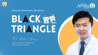 Black Triangle  Dr Edric Yeap Chun Hean General Dental Practitioner and Aesthetic Dentist [upl. by Ijat]