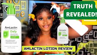 Amlactin Lotion Review Watch this before buying What Amlactin did to my skin Amlactin skincare [upl. by Aihsetal]