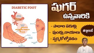 Diabetic Foot Care  Reduce Wounds and Cracked Heels  Healing Power  DrManthenas Health Tips [upl. by Georas]