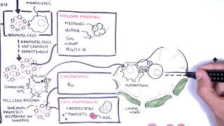 Systemic Lupus Erythematosus SLE  signs and symptoms pathophysiology investigations treatment [upl. by Dov]