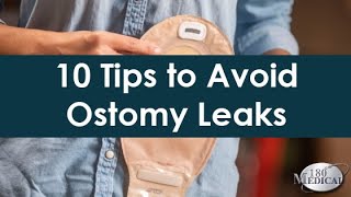 Common Ostomy Issues My Ostomy Bag Keeps Leaking [upl. by Pomona671]