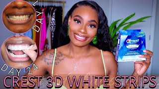 I Tried The Crest 3D White Strips for 24 Days  QuickAffordable Teeth Whitening  Before amp After [upl. by Ayalat]