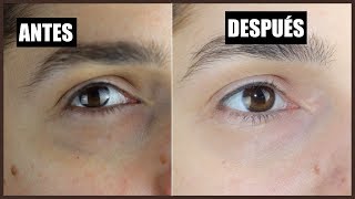 Como QUITAR las OJERAS EN 10 MINUTOS  REMEDIO CASERO II SARA MORA [upl. by Notlok]