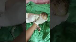 baby meconium passnewbornbaby  so pretty baby after birth very nice baby [upl. by Silliw]