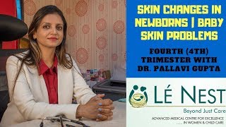 Skin Changes in NewBorns  4th Trimester  By Paediatrician DrPallavi Mukesh Gupta [upl. by Cleo]