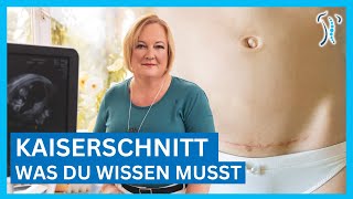 Gynäkologin erklärt Kaiserschnitt  Ablauf Narbe amp Heilung – Was du wissen musst [upl. by Yrelav]