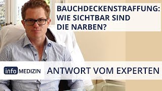 Bauchdeckenstraffung Sichtbare Narben  Expertenantwort von Dr Kiermeir [upl. by Natala]