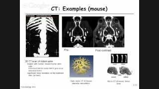 42  Computed tomography  Image reconstructionbackprojection [upl. by Candra]