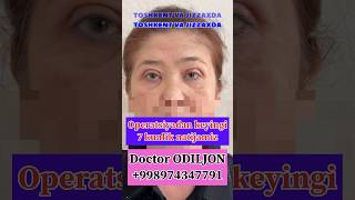 Qovoq olish  қовоқ олиш  blefaroplastika Doctor ODILJON 998974347791 TOSHKENT VA JIZZAXDA rek [upl. by Zahc691]