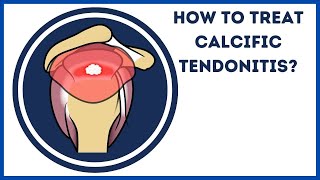 How to treat calcific tendonitis [upl. by Bigler]