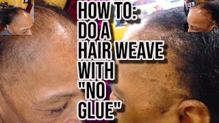 How To Do a HEALTHY HAIR WEAVE with Alopecia Thin Short Hair quotNo Gluequot [upl. by Josselyn226]