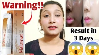 Melamet CreamUses Side effects Benefit remove Pigmentation Crystal glow MelasmaReview 2022 [upl. by Aronos214]