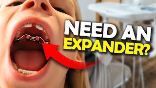 Getting a Palatal Expander What you NEED to know  McKinney Orthodontist [upl. by Noyart]