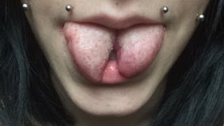 ◉ Tongue Split  Healing Process ◉ [upl. by Aicac]