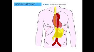 Latido epigástrico pptx [upl. by Repsac896]