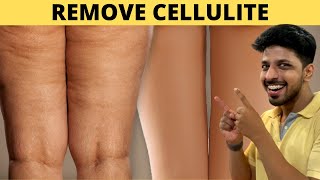 2 Simple Ways to Get Rid of CELLULITE Naturally [upl. by Nyliahs]