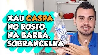 XAU CASPA NO ROSTO NA BARBA NA SOBRANCELHA E DESCAMAÇÃO  fubá online [upl. by Nica]