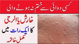 Kharash الرجی ka fori ilaj Top 3 Natural Remedies You Need to Try [upl. by Perry]