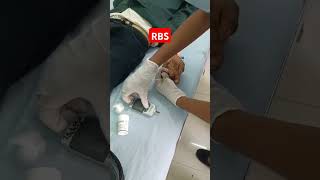 RBS। Normal Sugar test।। Sugar test।। shorts shortvideos foryou videoviral trending tranding [upl. by Yssis]