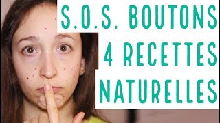 SOS BOUTONS  4 astuces MAISON pour les faire partir RAPIDEMENT et NATURELLEMENT [upl. by Adlay160]