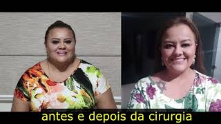 60 dias pós cirurgia bariátrica Bypass  antes e depois  176 Kg a menos [upl. by Musette]