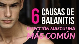 6 Causas de Balanitis  la infección masculina más común 👨‍⚕️ [upl. by Eelyma]