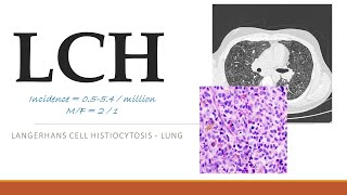 LCH  Unraveling LANGERHANS CELL HISTIOCYTOSIS A Comprehensive Guide [upl. by Eanehs]